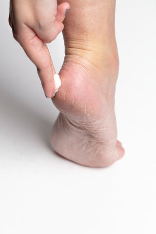 Foot Miracle Therapeutic Cream 6oz